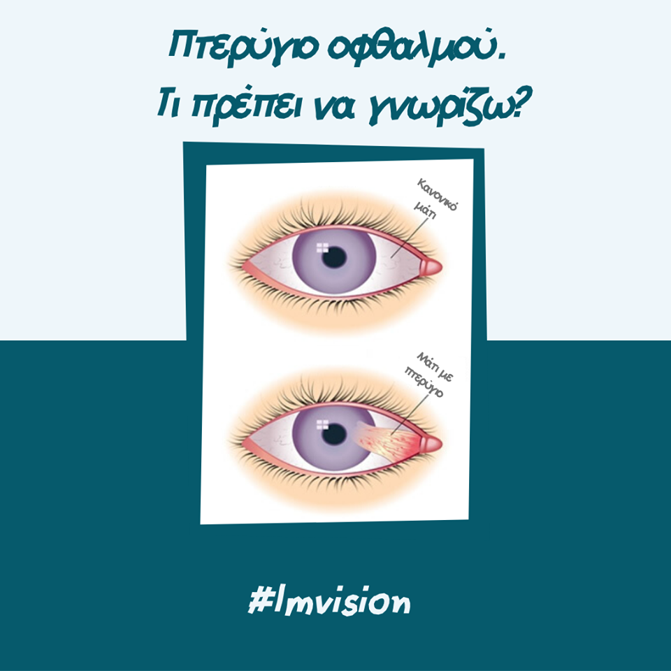 Πτερύγιο οφθαλμού. Τι πρέπει να γνωρίζω?